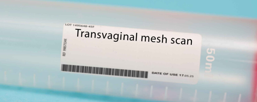 transvaginal mesh