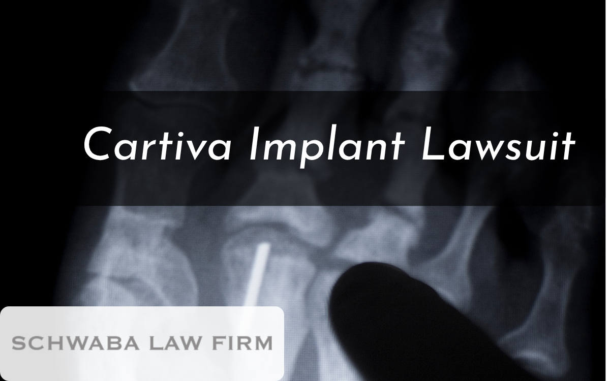 cartiva toe implant lawsuit